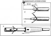 Рис. 2. Последовательность установки штекера